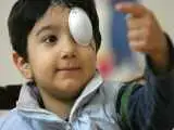2 میلیون کودک از نابینایی نجات پیدا کردند