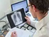 مرگ بارترین سرطان در دنیا