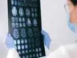 حافظه موش های مبتلا به آلزایمر بهبود یافت حالا نوبت انسان است  -  نتایج امیدوار کننده با پروتئین (ناو 1.1)