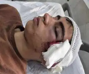 ضرب وشتم دانش آموز با دسته صندلی  -  روایت پدر از خشونت بر علیه فرزندش در دبیرستان دهبکری بم  -  آموزش وپرورش وعده پیگیری داد + عکس