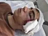 ضرب وشتم دانش آموز با دسته صندلی  -  روایت پدر از خشونت بر علیه فرزندش در دبیرستان دهبکری بم  -  آموزش وپرورش وعده پیگیری داد + عکس