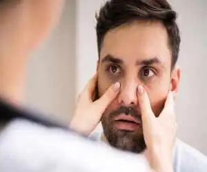 واقعا کمبود آهن را می توان از روی چهره تشخیص داد؟ علائمی که باید جدی بگیرید