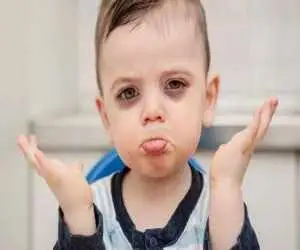 تیرگی زیر چشم کودکان نشانه چیست ؛ کم خونی، حساسیت یا ارثی؟