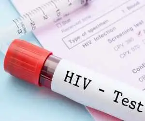 مبتلایان hiv خدمت سربازی نمی روند